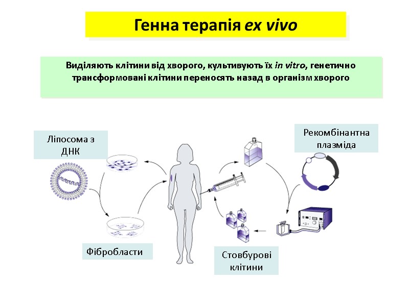 Генна терапія ex vivo Виділяють клітини від хворого, культивують їх in vitro, генетично трансформовані Генна терапія ex vivo Виділяють клітини від хворого, культивують їх in vitro, генетично трансформовані